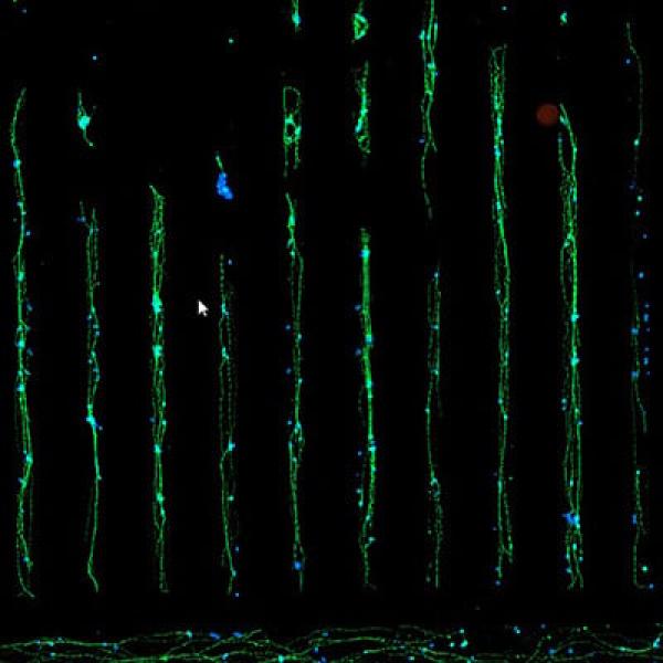 Human RealDRG grown on the µ-Slide VI 0.4 µ-Pattern ibiTreat lin20