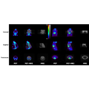 MRI inserts for IRIS PET systems