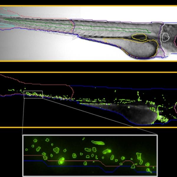 Zebrafish Tail Region Cell Counting