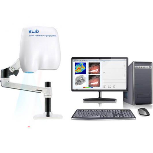Laser speckle contrast imaging system