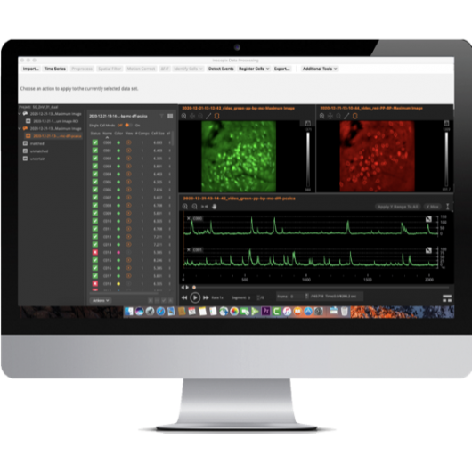 nVue Monitor