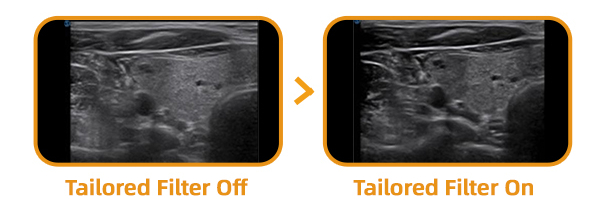 x-ray1.png
