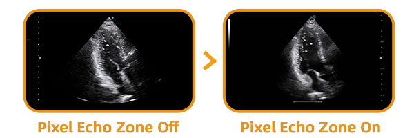 x-ray2.png