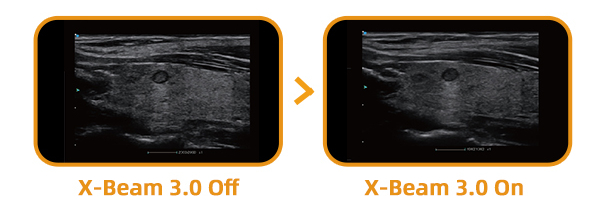 x-ray3.png